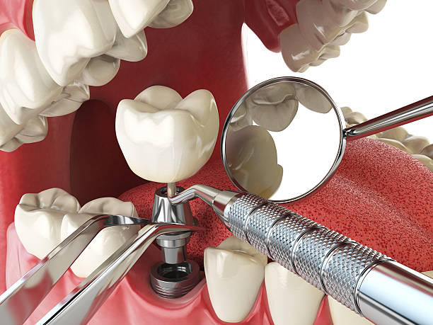 Best Weekend Emergency Dentist in New Market, MD